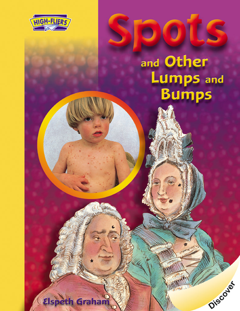 Spots and Other Lumps and Bumps